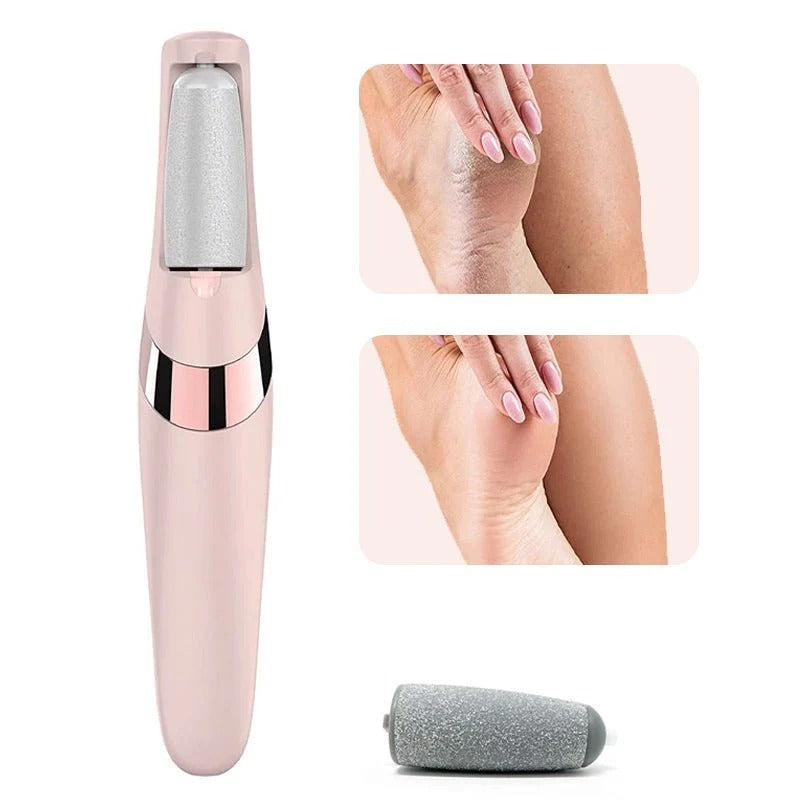 Rechargeable Electric Foot Callus Remover – 2-Speed Pedicure Foot File